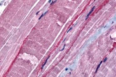 Immunohistochemistry-Paraffin: GRK5 Antibody [NBP3-14368] - Immunohistochemistry of formalin-fixed, paraffin-embedded human skeletal muscle after heat-induced antigen retrieval.